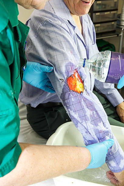 Lead Burn-Care Specialist